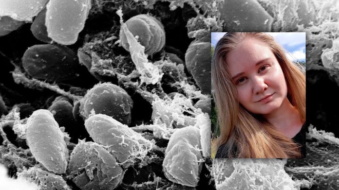 197 pessoas isoladas após morte por Peste Pneumônica: Funcionária de laboratório de doenças infecciosas morre na Rússia após se infectar ao quebrar tubo de ensaio